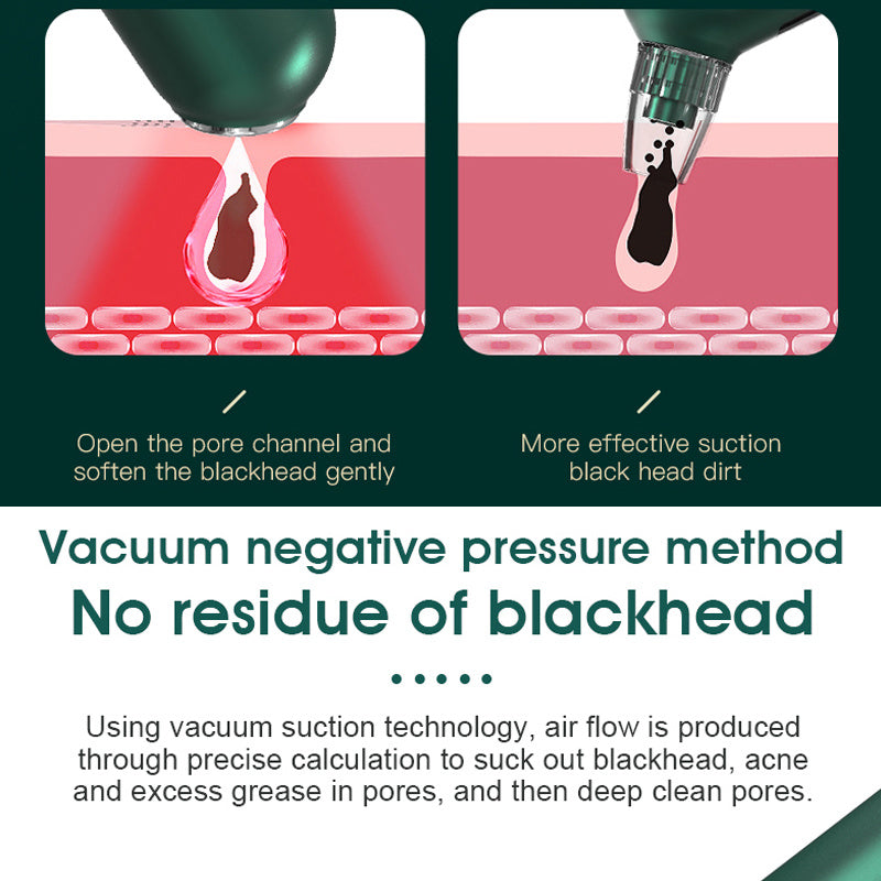 Hot Compress Blackhead Beauty