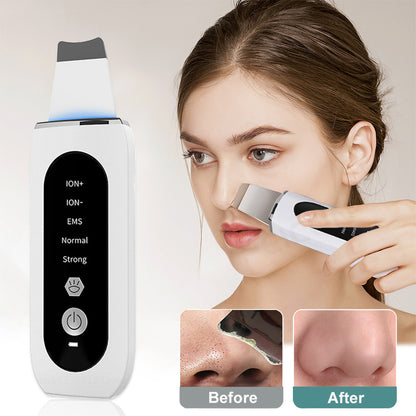 Ultrasonic Skin Scrubber with Microcurrent & LED Light Therapy
