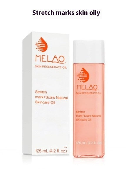 Stretch Marks Skin Care Moisturizing Hydrating